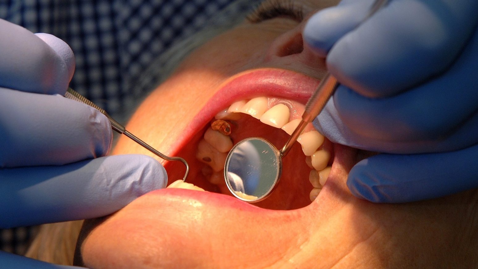 Ministers vow boost dentistry access with 700,000 appointments rollout