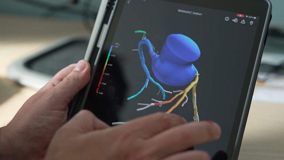 State of the art 3D heart scanner saves lives and NHS millions
